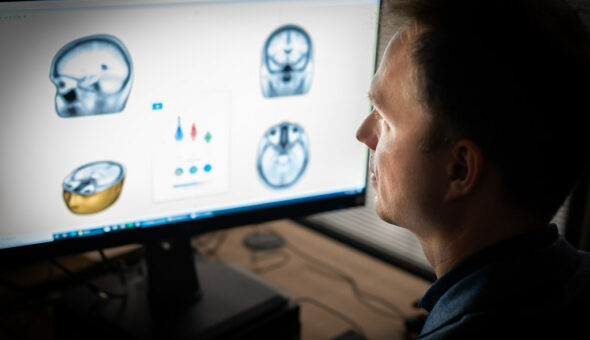 Man looking at computer screen which has images of the head and brain